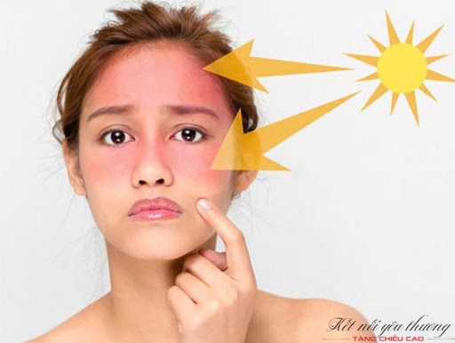 Ánh nắng mặt trời có thể gây hại cho da